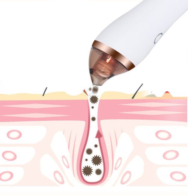 Product-03-4 in 1 Body Guasha Cupping Blackhead Remover Machine Facial Pore Deep Cleansing Beauty Skin Care